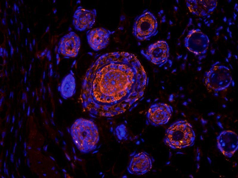 IL10 Rabbit Polyclonal Antibody