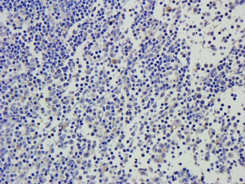 IL10 Rabbit Polyclonal Antibody