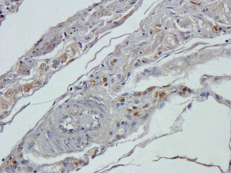IL10 Rabbit Polyclonal Antibody