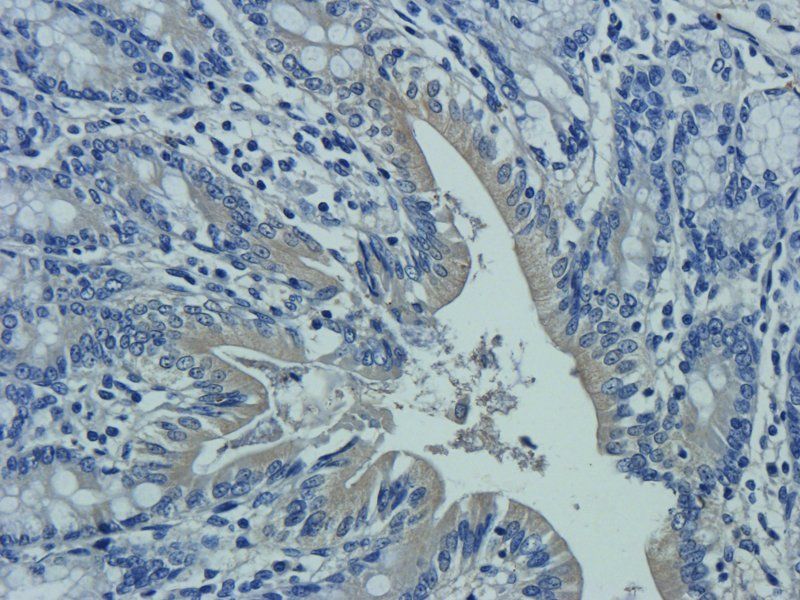 IL10 Rabbit Polyclonal Antibody