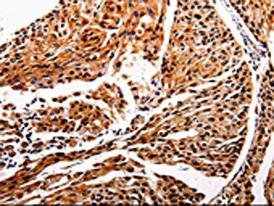 IL10RB Antibody