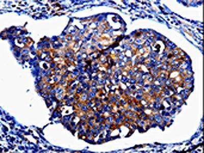 IL10RB Antibody