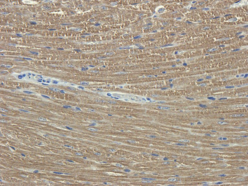IL11 Rabbit Polyclonal Antibody