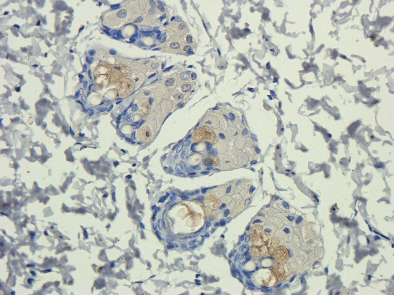 IL11 Rabbit Polyclonal Antibody