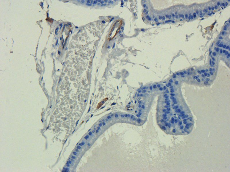 IL11 Rabbit Polyclonal Antibody