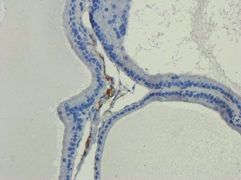 IL11 Rabbit Polyclonal Antibody