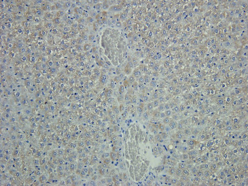 IL11 Rabbit Polyclonal Antibody