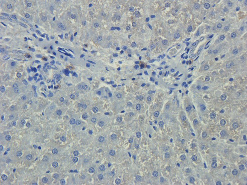 IL11 Rabbit Polyclonal Antibody
