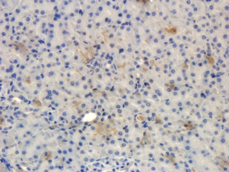 IL11 Rabbit Polyclonal Antibody