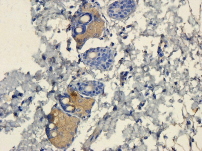 IL11 Rabbit Polyclonal Antibody