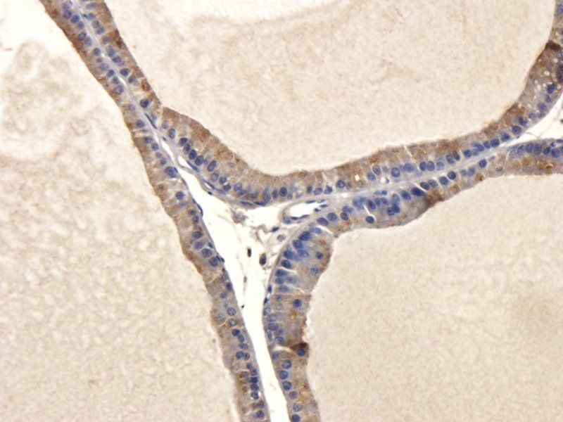 IL11 Rabbit Polyclonal Antibody