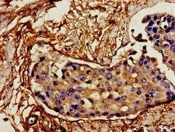 IL12A Antibody