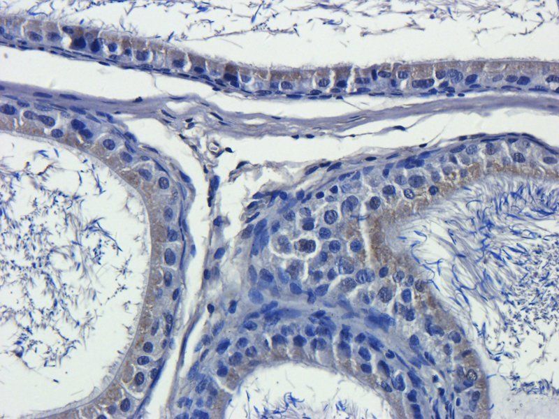 IL13 Rabbit Polyclonal Antibody