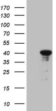 IL15 Antibody
