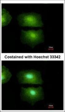 IL16 Rabbit Polyclonal Antibody