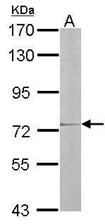 IL17 Receptor D Rabbit Polyclonal Antibody