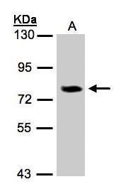IL17 Receptor D Rabbit Polyclonal Antibody