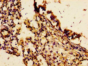 IL18R1 Antibody