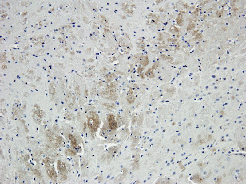 IL1 alpha Rabbit Polyclonal Antibody