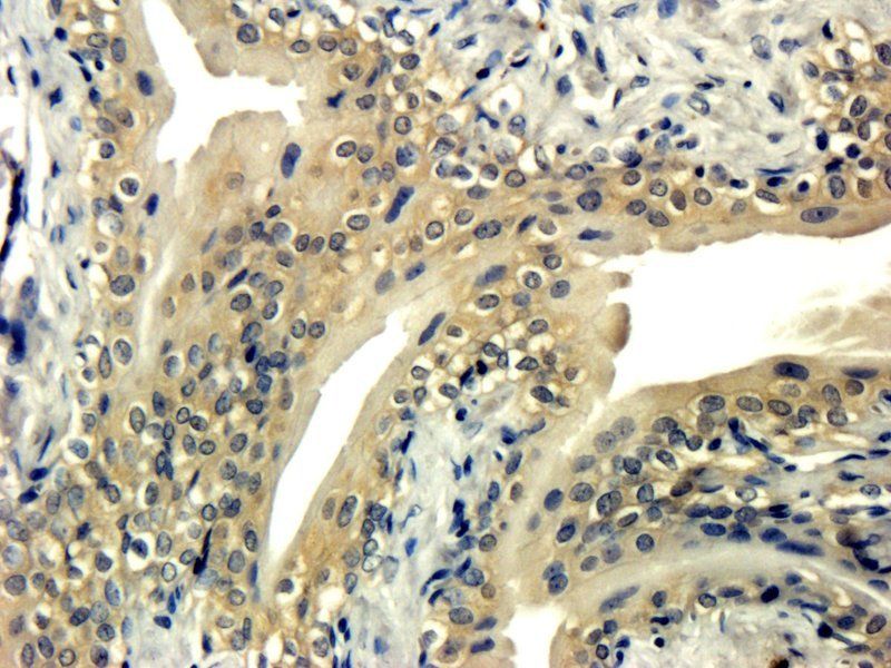 IL1 alpha Rabbit Polyclonal Antibody