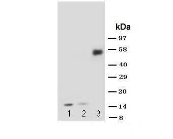 IL1 beta/IL1B Rabbit Polyclonal Antibody