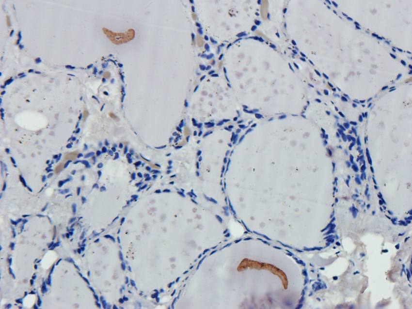 IL1 beta Rabbit Polyclonal Antibody