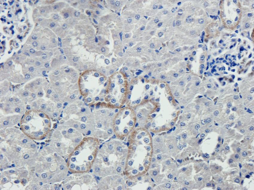 IL1 beta Rabbit Polyclonal Antibody