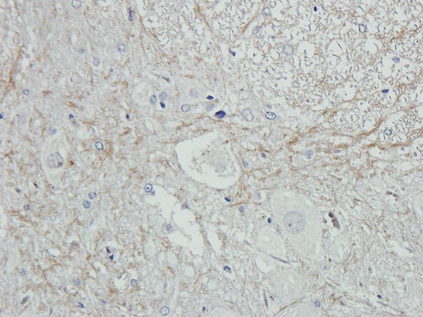 IL1 beta Rabbit Polyclonal Antibody