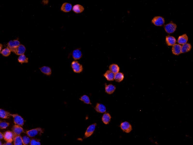 IL1RA Rabbit Polyclonal Antibody