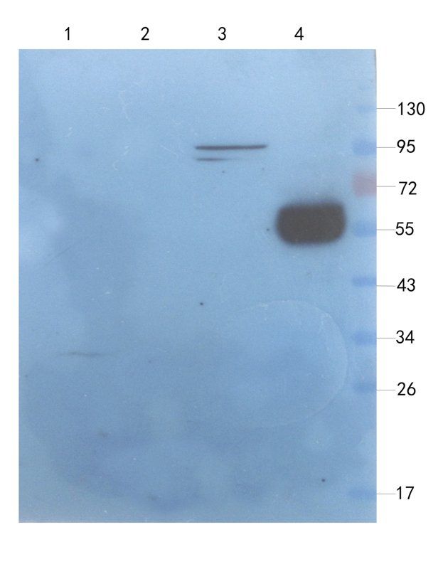 IL1 RA Rabbit Polyclonal Antibody