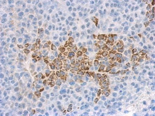 IL1F9 Rabbit Polyclonal Antibody