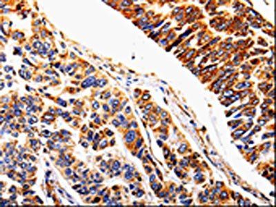 IL1R2 Antibody