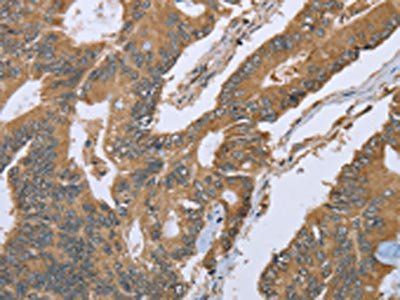 IL1RN Antibody