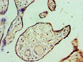 IL1RAP Antibody