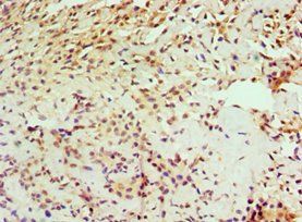 IL1RAP Antibody