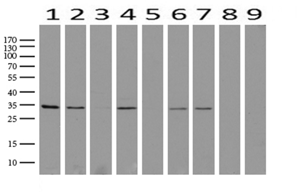 IL20 Receptor alpha Antibody