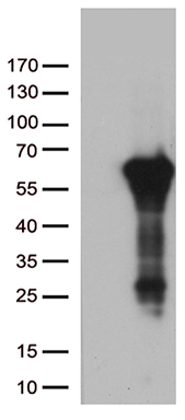IL20RA Antibody