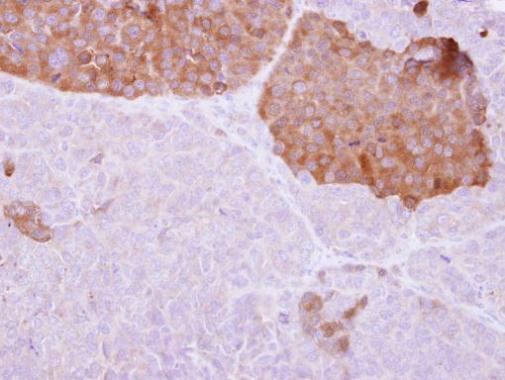 IL22 Receptor alpha 2 Rabbit Polyclonal Antibody