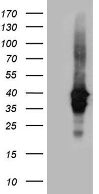 IL23R Antibody