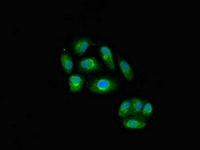 IL23A Antibody