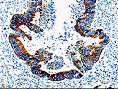 IL23R Antibody