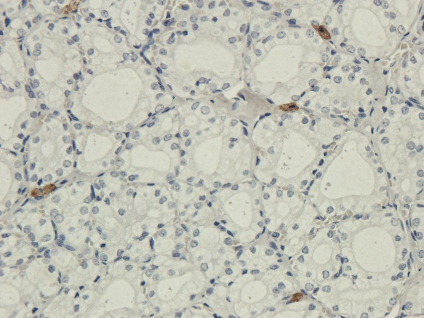 IL26 Rabbit Polyclonal Antibody