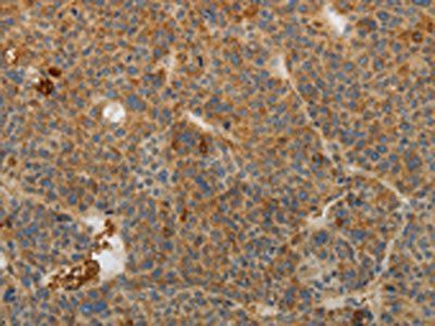 IL27 Antibody