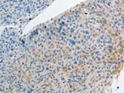 IL27 Antibody