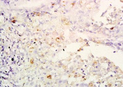 IL32 Rabbit Polyclonal Antibody