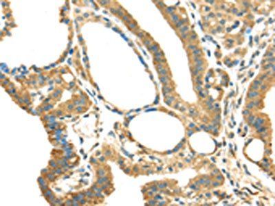 IL3RA Antibody