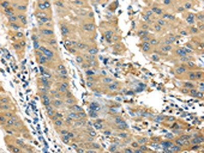 IL3RA Antibody