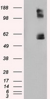 IL6 Antibody