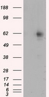 IL6 Antibody