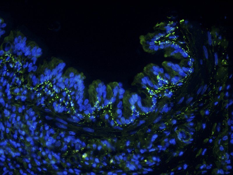 IL6 Rabbit Polyclonal Antibody (FITC)